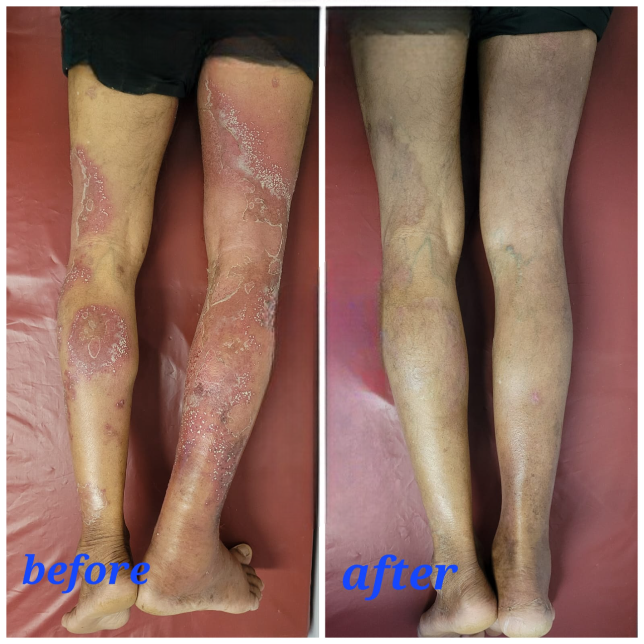 59dc68e9464980a972acdeb14de987f1-Photoroom 59dc68e9464980a972acdeb14de987f1-Photoroom